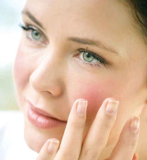 Qu&rsquo;est-ce qui cause les joues roses et comment est-ce géré ?