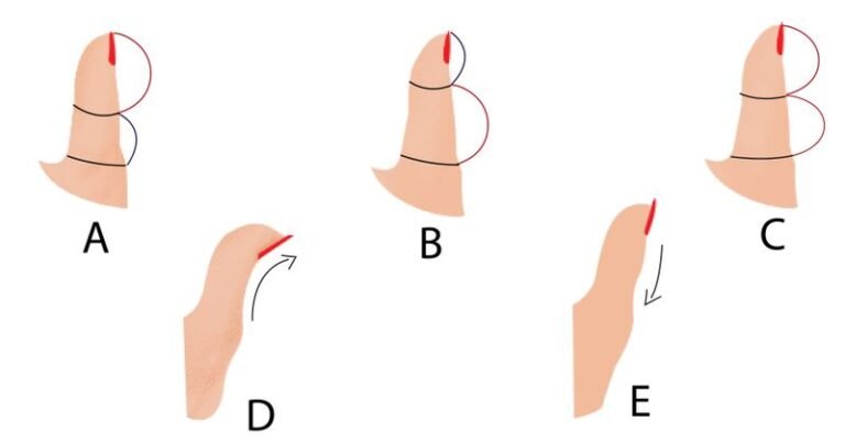 Voici ce que révèle la forme de votre pouce sur votre personnalité